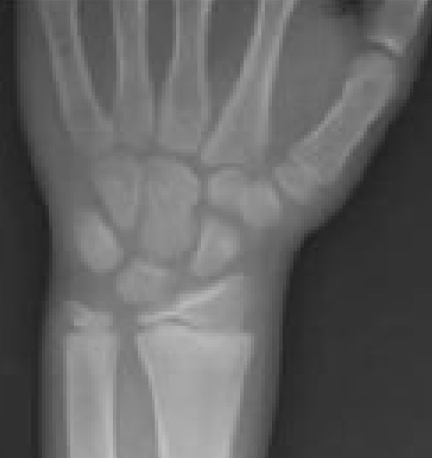 11 years hand